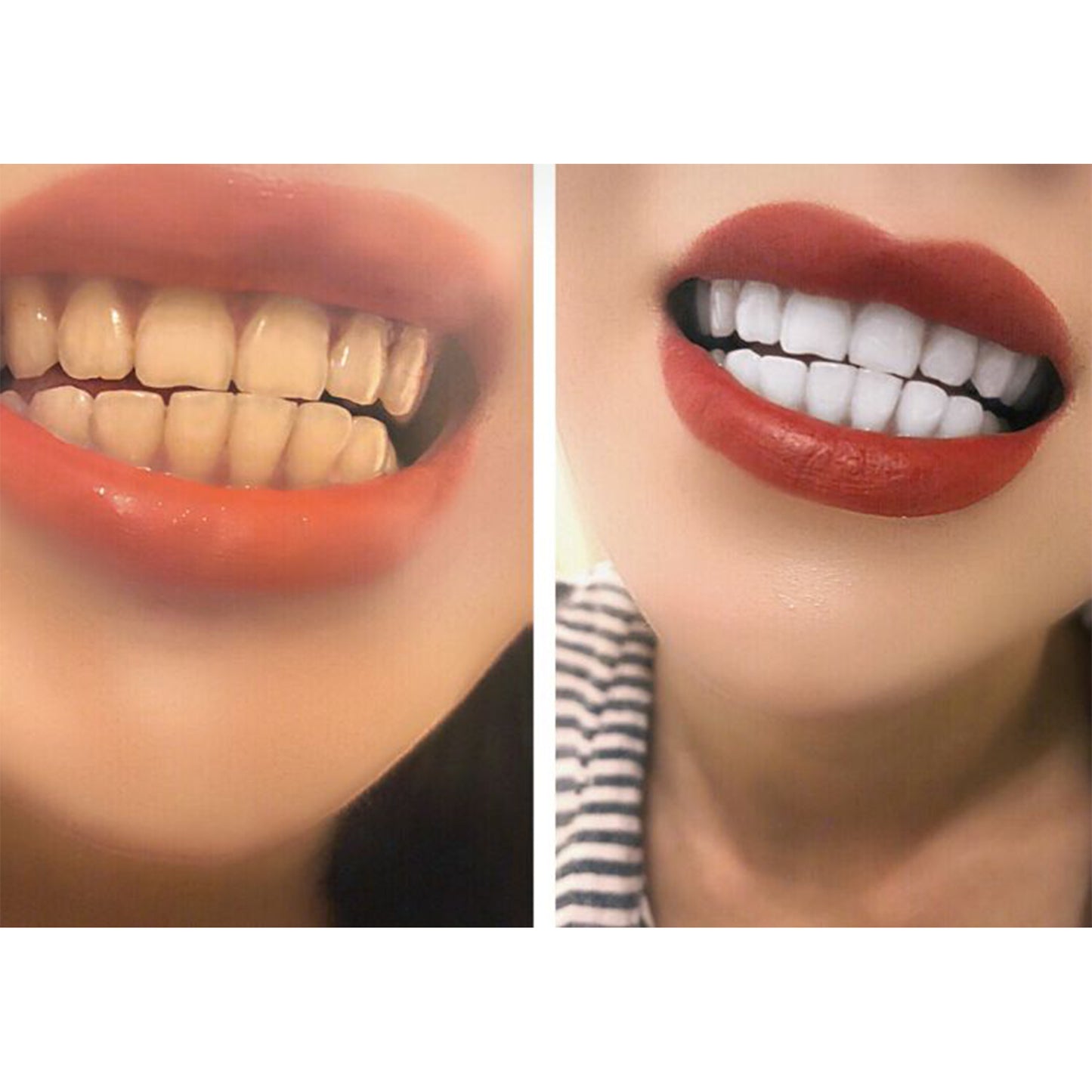 U-Smile